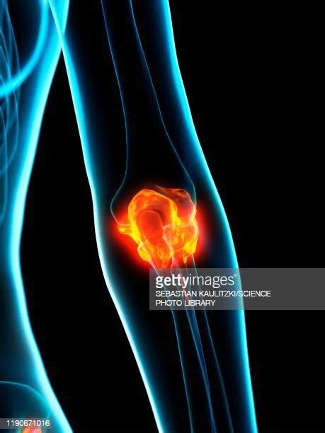 Woman Inner Elbow Photos And Premium High Res Pictures Getty Images