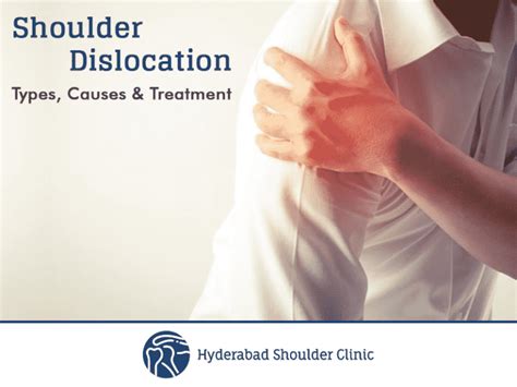 Shoulder Dislocation Types Causes And Treatment Shoulder Clinic