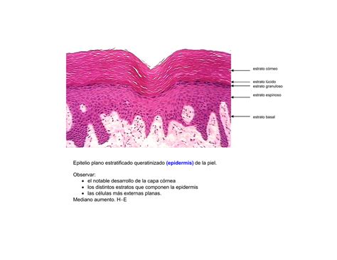 Epitelio Plano Estratificado Queratinizado Epidermis De La Piel