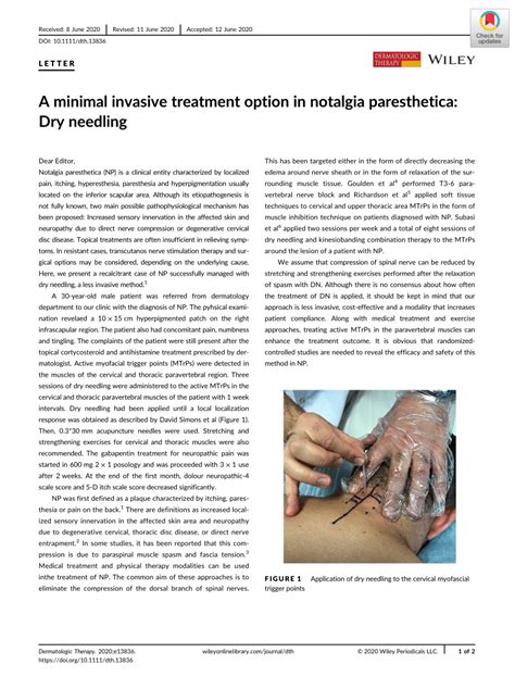 Pdf A Minimal Invasive Treatment Option In Notalgia Paresthetica Dry