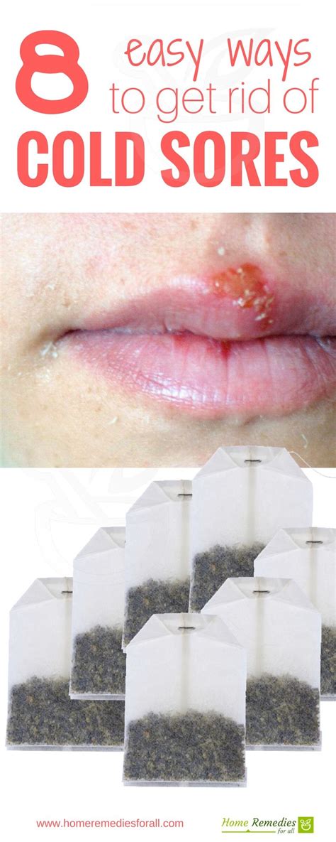 Get Rid Of Cold Sores With 8 Simple But Very Effective Home Remedies