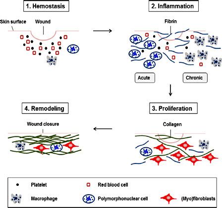There is increasing evidence that cutaneous innervation. Schematic representation of the basic steps of cutaneous ...