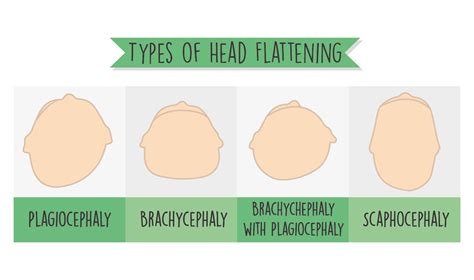 The Flat Head Syndrome Fix — Cando Kiddo