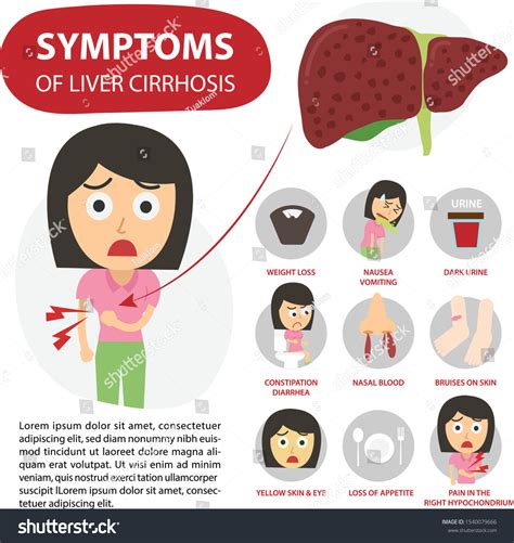 Infographics Woman Sign Symptoms Liver Disease Vector De Stock Libre