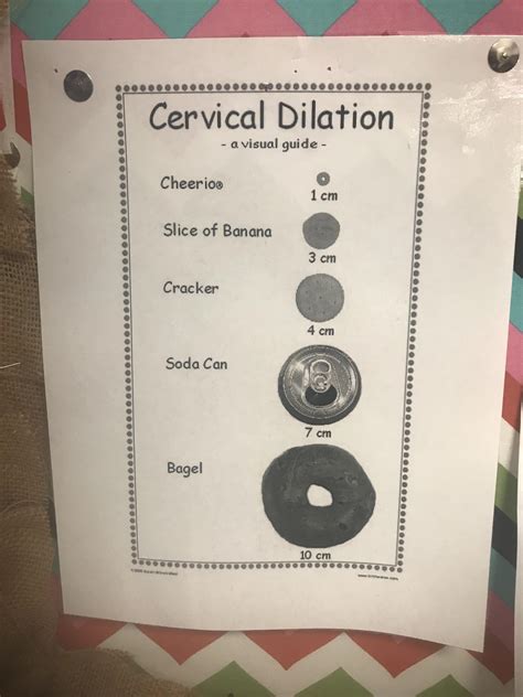 Chart Illustrating Dilation Of Cervix During Labor Mildlyinteresting My Xxx Hot Girl