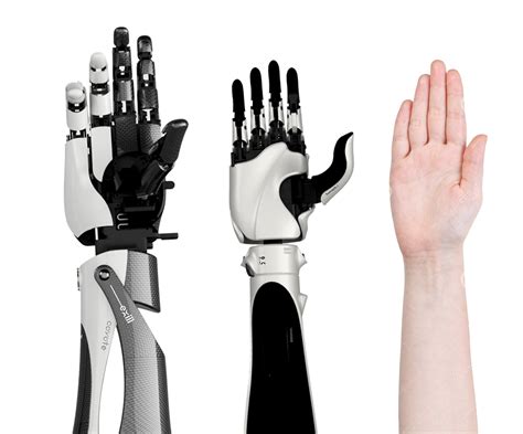 The Hackberry Is A D Printable Myoelectric Prosthetic Arm Created By
