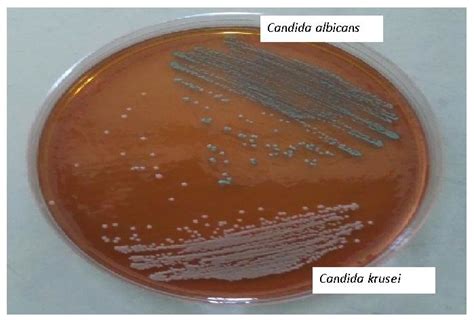 Colonies Of C Albicans Green And C Krusei Pink On Candida Chrome