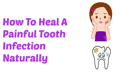 How To Heal A Painful Tooth Infection Naturally Youtube