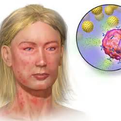 Learn about shock, symptoms, treatment, diagnosis, causes (insect stings, latex allergy, food allergy, medication allergy). 11 Pictures of Anaphylaxis Symptoms
