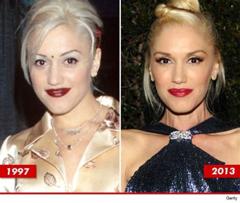 Gwen Stefani Plastic Surgery The Transformation That Made Look Great