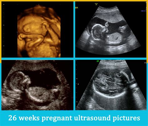 26 Weeks Pregnant 4d Ultrasound Printable Templates Free