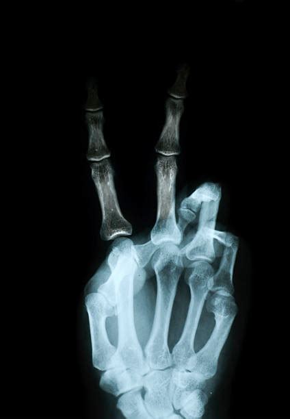 Funny Xray Pictures