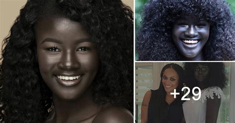 Teen Bullied For Having Exceptionally Dark Skin Color Becomes Model