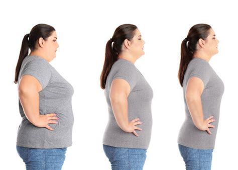 Before After Weight Loss Images Browse 7801 Stock Photos Vectors