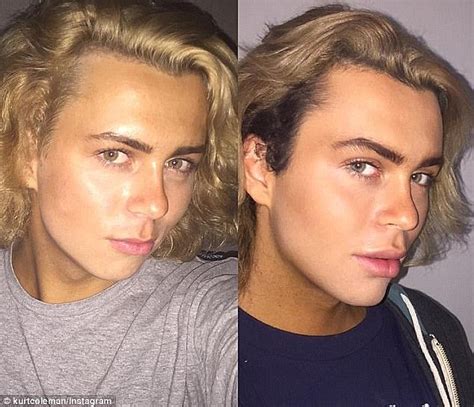 How Instagram Star Kurt Colemans Face Has Changed Daily Mail Online