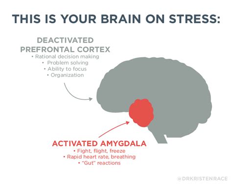 Do You Know Your Amygdala 🧠your Dr Kristen Race