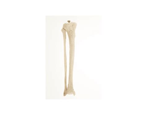 Tibia And Fibula Right Leg Anterior View Quiz