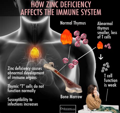 The mean of zinc concentration was 0. 6 Benefits Of Aloe + 5 Uses For The Skin - DrJockers.com