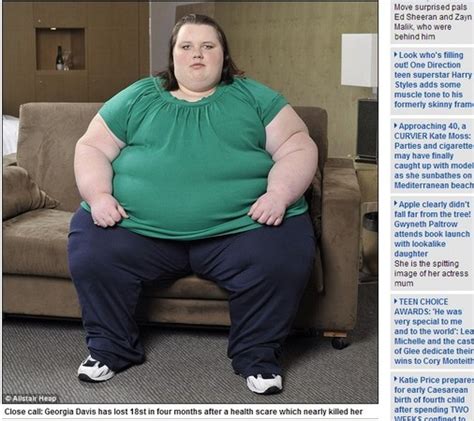 太胖也會導致器官衰竭！ 英最胖少女狂減119公斤 Et Fashion Ettoday新聞雲