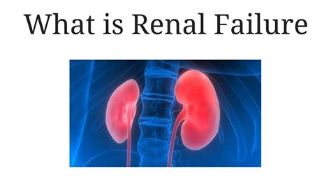 Renal vascular disease affects the blood flow into and out of the kidneys. what is renal failure / Symptoms of kidney failure ...