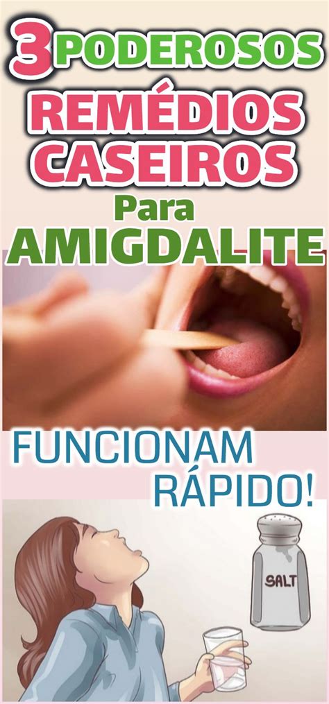 Poderosos remédios para amigdalite que funcionam rápido BOAS DICAS Remédios para dor de