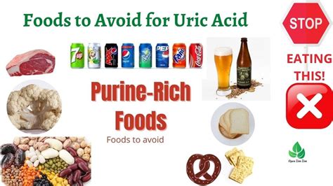 Stop Eating This Foods To Avoid For Uric Acid Gout Natural Cure