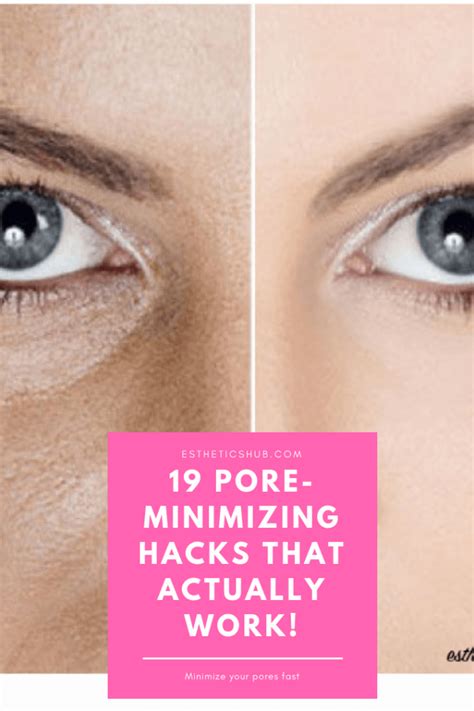 How To Minimize Your Pores 19 Hacks That Actually Work