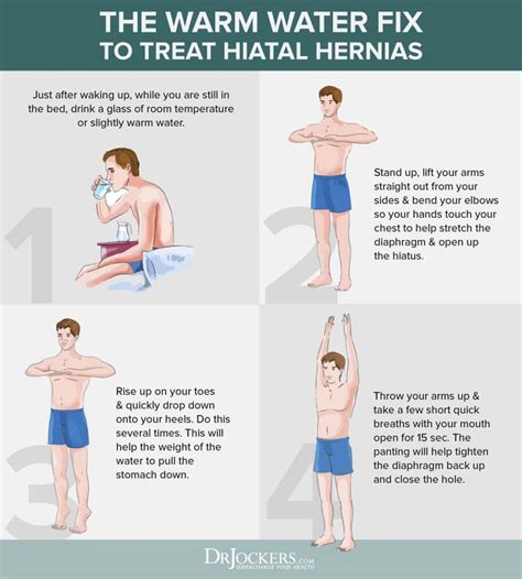 How To Reduce Inguinal Hernia Manually