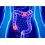 Colorectal Cancer Mortality Rates Increasing In Younger White Adults 