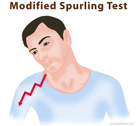 Spurlings Test Or Cervical Axial Compression Test Cervical Pinched