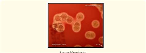 Beta Hemolytic β Hemolysis Of Staphylococcus Aureus Colonies On