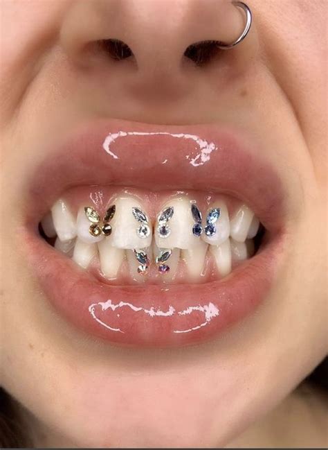 Teeth Jewel Teeth Jewelry Diamond Teeth Dental Jewelry