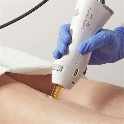 Laser Ontharing Met De Gentlemax Pro Plus Hi Beauty And Laser Clinic