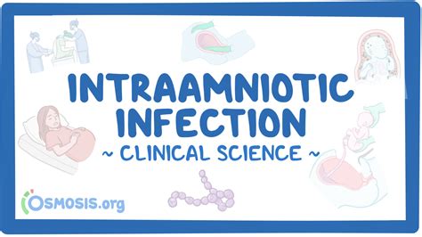 Intraamniotic Infection Clinical Sciences Osmosis Video Library
