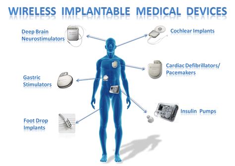 Multi Functional Chip Development Make The Innovation Of The Next