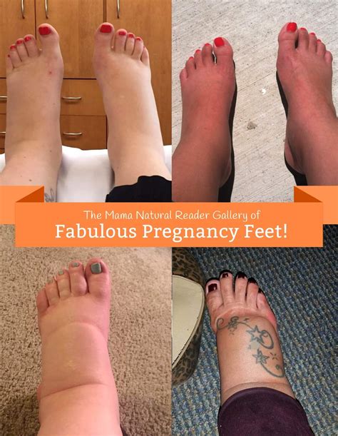 How To Remove Swelling From Feet During Pregnancy Pregnancywalls