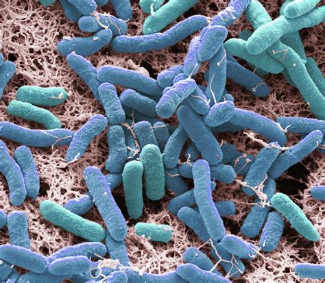 Pseudomonas Bacteria Photograph By Steve Gschmeissnerscience Photo Library