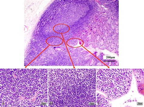 Morphologic Observation Of Mucosa‐associated Lymphoid Tissue In The
