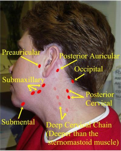 Surface Anatomy Lymph Nodes Flashcards Quizlet