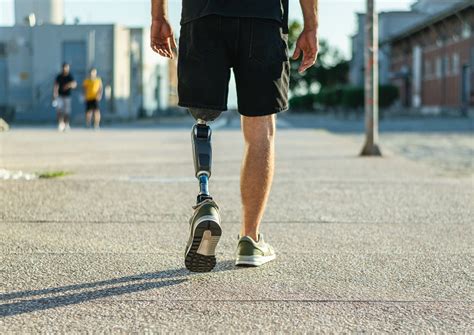 Is A Prosthetic Worth It Can You Walk Normally With A Prosthetic Leg