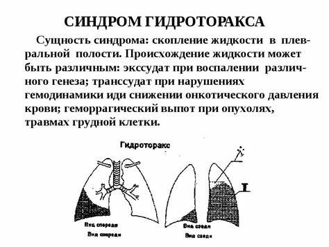 Диета При Гидротораксе Легких — Похудение Диета Правильное Питание Картинка - Диета При Гидротораксе Легких — Похудение Диета Правильное Питание