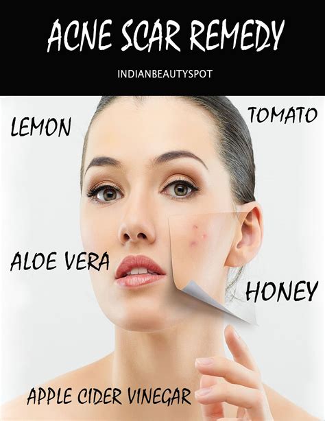 How To Get Rid Of Acne Scabs On Face Overnight Diy Get Rid Of Bumps