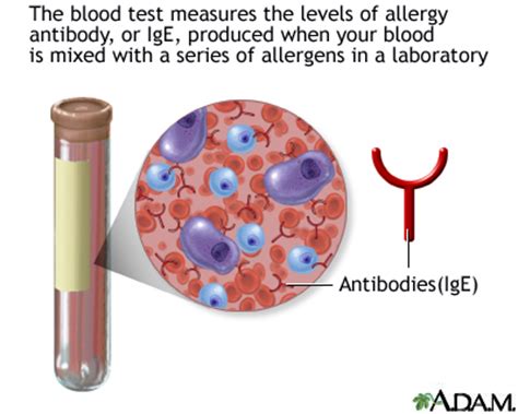 Right now there is no cure for food allergies: RAST test: MedlinePlus Medical Encyclopedia Image