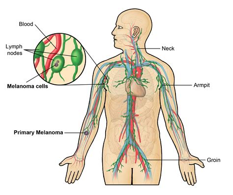 Lymph Node Diagrams 101 Diagrams