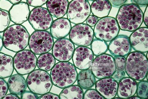 Cortex Of Ranunculus Root Parenchyma Tissue With Starch Grains