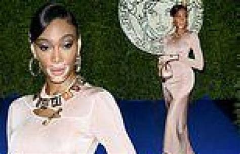 Winnie Harlow Showcases Her Impeccable Sense Of Style In Figure Hugging Nude