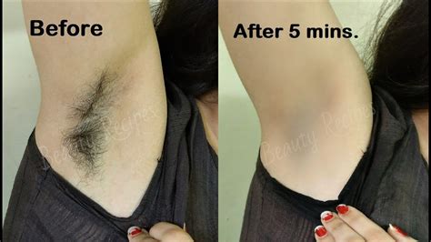 For this mask, you will need two eggs and 2 tbsps of aloe vera gel. How i removed my Armpit Hair - NO WAX | SHAVE & Remove ...