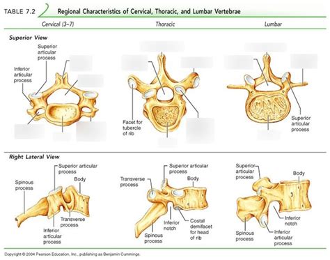 Superior Right Lateral Views Of Typical Vertebrae Diagram Quizlet
