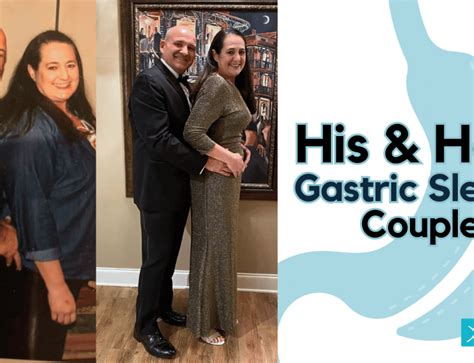 Touching Story Of Undergoing Gastric Sleeve In Mexico
