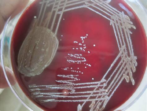Streptococcus Spp Isolated On Blood Agar Showing Semi Translucent